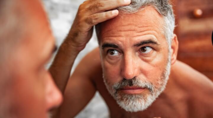 age spots