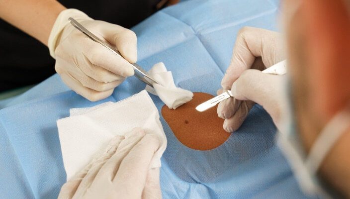 providers performing mohs surgery)